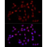 Immunofluorescence - Anti-Histone H3 (tri methyl Lys27) Antibody (A16711) - Antibodies.com