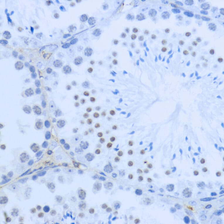 Immunohistochemistry - Anti-Histone H3 (di methyl Lys36) Antibody (A16713) - Antibodies.com