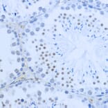 Immunohistochemistry - Anti-Histone H3 (di methyl Lys36) Antibody (A16713) - Antibodies.com