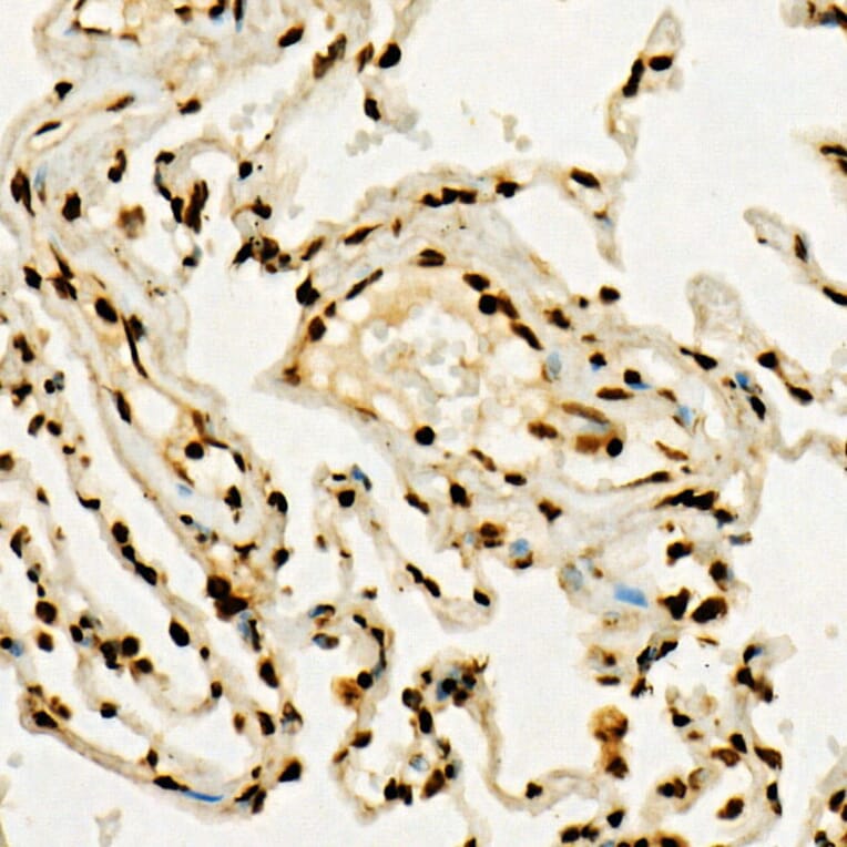 Immunohistochemistry - Anti-Histone H3 (tri methyl Lys36) Antibody (A16714) - Antibodies.com