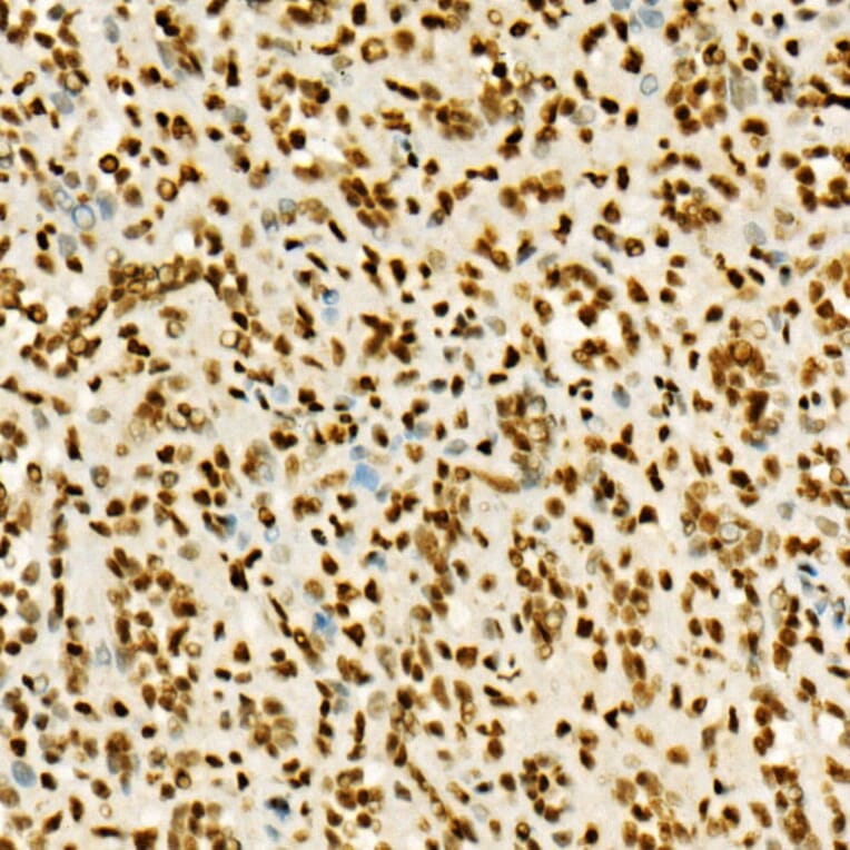 Immunohistochemistry - Anti-Histone H3 (tri methyl Lys36) Antibody (A16714) - Antibodies.com