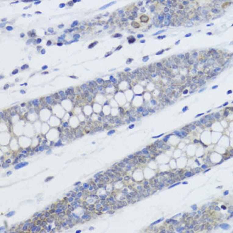 Immunohistochemistry - Anti-Histone H4 (mono methyl Lys20) Antibody (A16718) - Antibodies.com