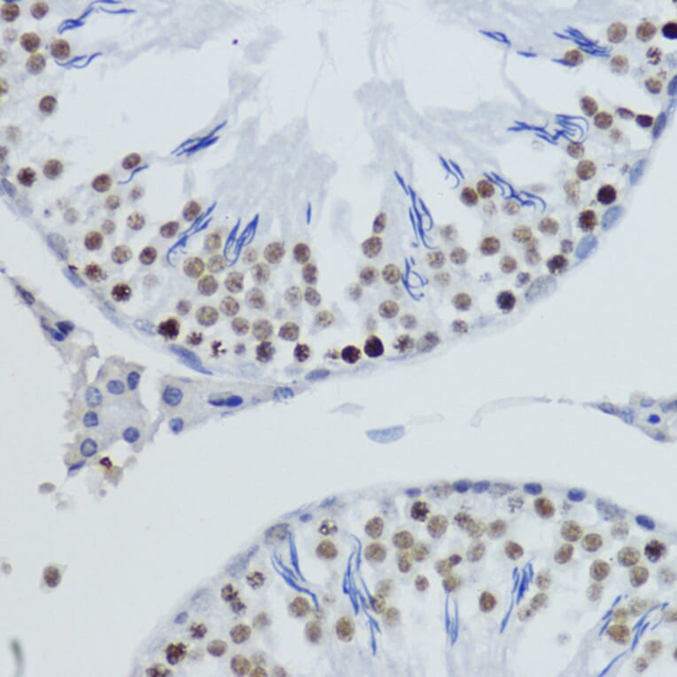 Immunohistochemistry - Anti-Histone H4 (di methyl Lys20) Antibody (A16719) - Antibodies.com