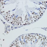 Immunohistochemistry - Anti-Histone H4 (di methyl Lys20) Antibody (A16719) - Antibodies.com