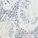 Immunohistochemistry - Anti-Histone H4 (di methyl Lys20) Antibody (A16719) - Antibodies.com