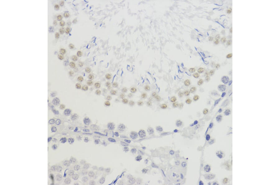 Immunohistochemistry - Anti-Histone H4 (tri methyl Lys20) Antibody (A16720) - Antibodies.com
