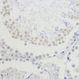 Immunohistochemistry - Anti-Histone H4 (tri methyl Lys20) Antibody (A16720) - Antibodies.com