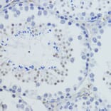 Immunohistochemistry - Anti-Histone H4 (tri methyl Lys20) Antibody (A16720) - Antibodies.com