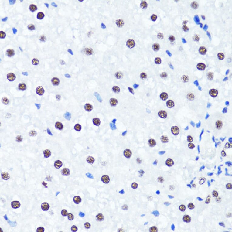 Immunohistochemistry - Anti-Histone H3 (di methyl Arg2) Antibody (A16721) - Antibodies.com