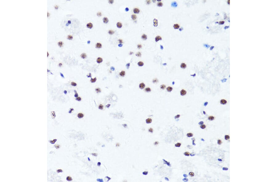 Immunohistochemistry - Anti-Histone H3 (di methyl Arg2) Antibody (A16721) - Antibodies.com