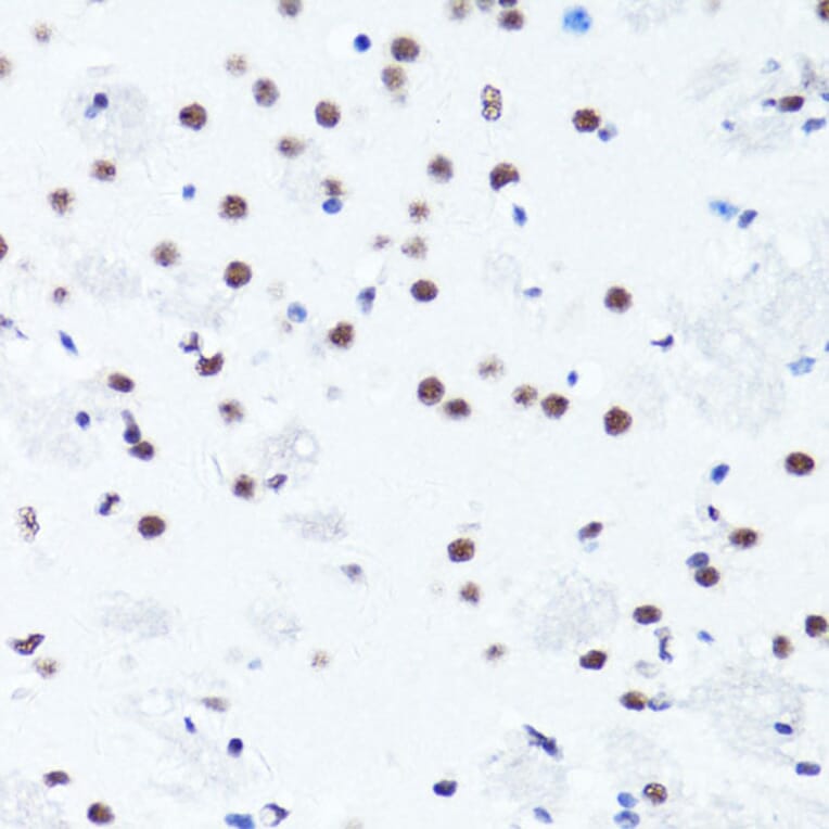 Immunohistochemistry - Anti-Histone H3 (di methyl Arg2) Antibody (A16721) - Antibodies.com