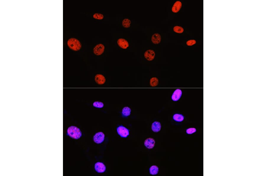 Immunofluorescence - Anti-Histone H3 (di methyl Arg2) Antibody (A16721) - Antibodies.com
