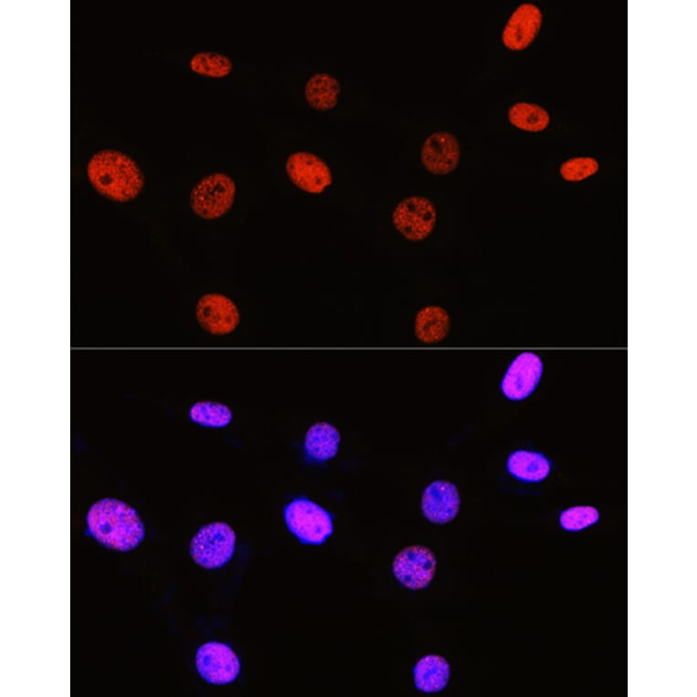 Immunofluorescence - Anti-Histone H3 (di methyl Arg2) Antibody (A16721) - Antibodies.com
