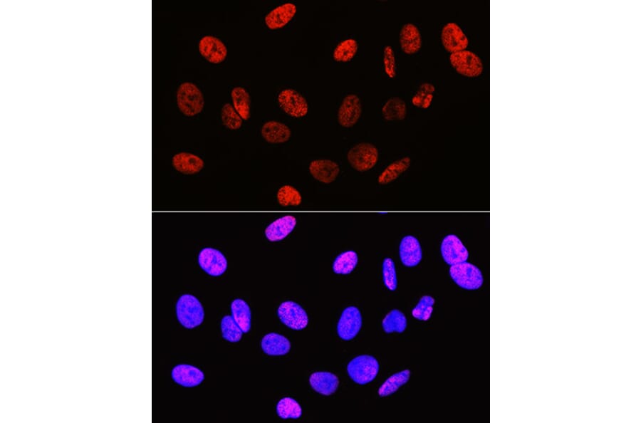Immunofluorescence - Anti-Histone H3 (di methyl Arg2) Antibody (A16721) - Antibodies.com