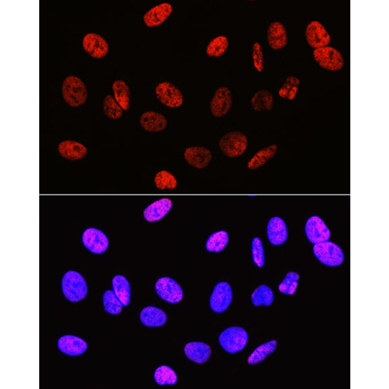 Immunofluorescence - Anti-Histone H3 (di methyl Arg2) Antibody (A16721) - Antibodies.com