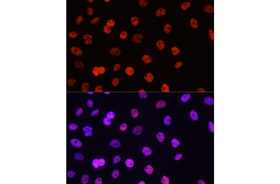 Immunofluorescence - Anti-Histone H3 (asymmetric di methyl Arg17) Antibody (A16725) - Antibodies.com