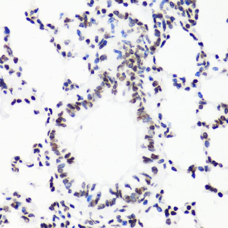Immunohistochemistry - Anti-Histone H3 (mono methyl Arg17) Antibody (A16726) - Antibodies.com