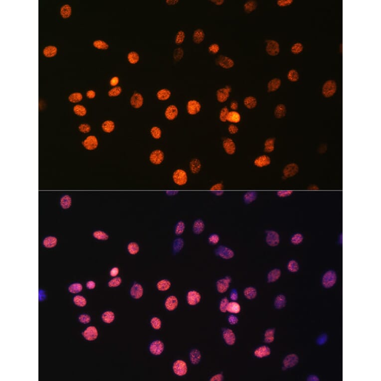 Immunofluorescence - Anti-Histone H3 (mono methyl Arg17) Antibody (A16726) - Antibodies.com