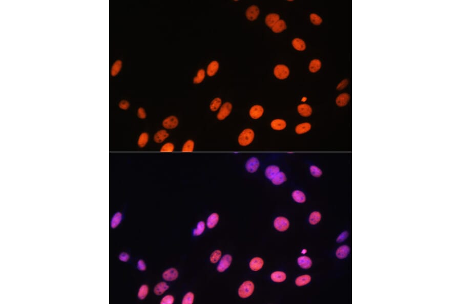 Immunofluorescence - Anti-Histone H3 (mono methyl Arg17) Antibody (A16726) - Antibodies.com