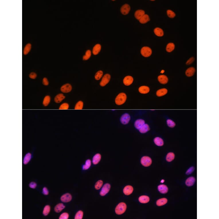 Immunofluorescence - Anti-Histone H3 (mono methyl Arg17) Antibody (A16726) - Antibodies.com