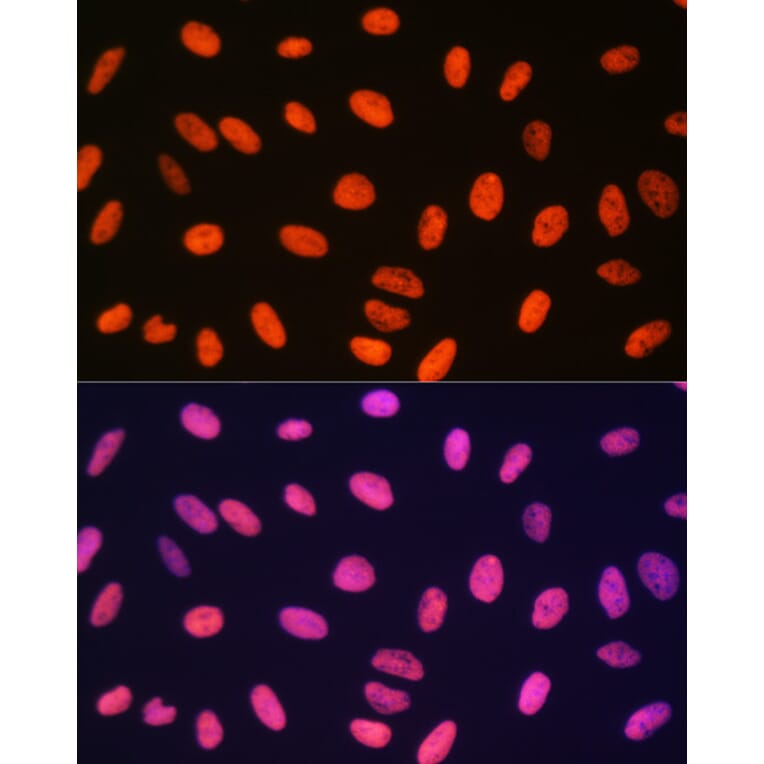 Immunofluorescence - Anti-Histone H3 (mono methyl Arg17) Antibody (A16726) - Antibodies.com