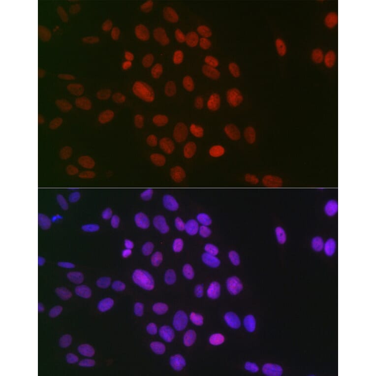 Immunofluorescence - Anti-Histone H3 (di methyl Arg26) Antibody (A16728) - Antibodies.com