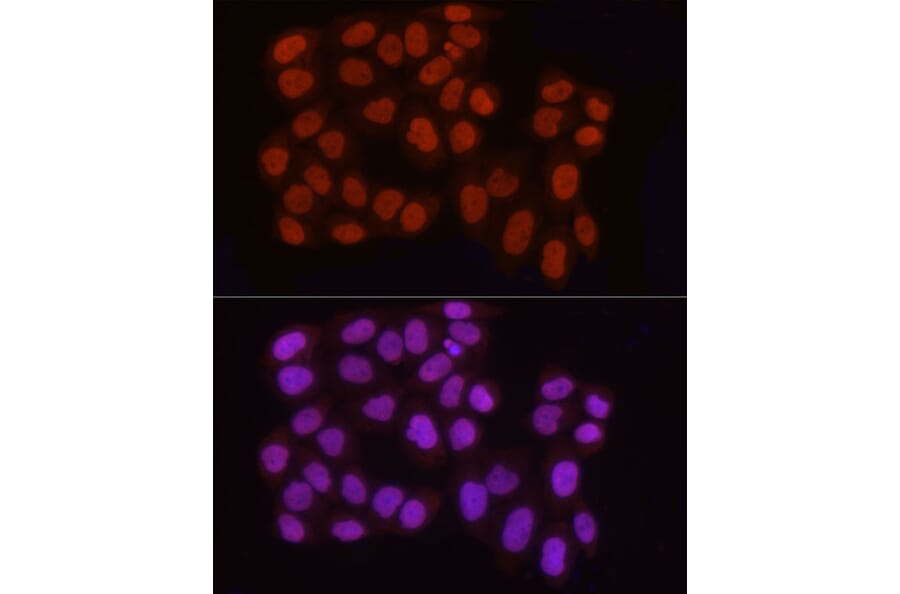 Immunofluorescence - Anti-Histone H3 (asymmetric di methyl Arg2) Antibody (A16730) - Antibodies.com