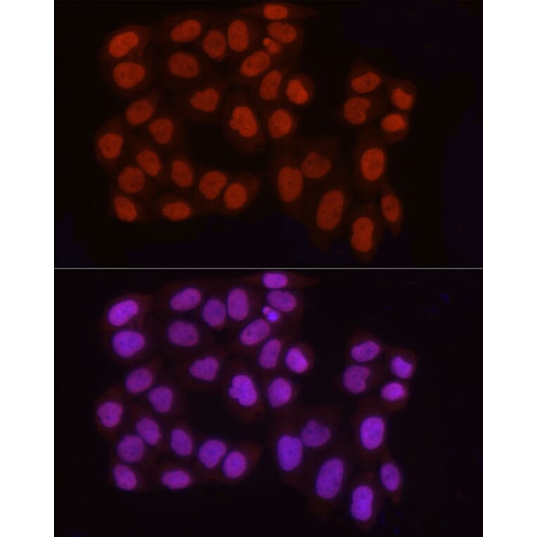 Immunofluorescence - Anti-Histone H3 (asymmetric di methyl Arg2) Antibody (A16730) - Antibodies.com
