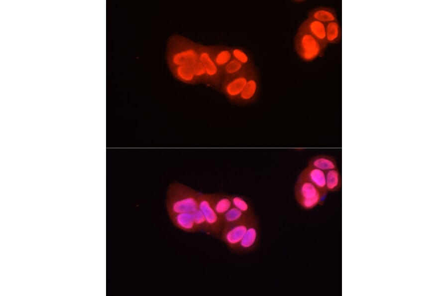 Immunofluorescence - Anti-Histone H3 (asymmetric di methyl Arg2) Antibody (A16730) - Antibodies.com