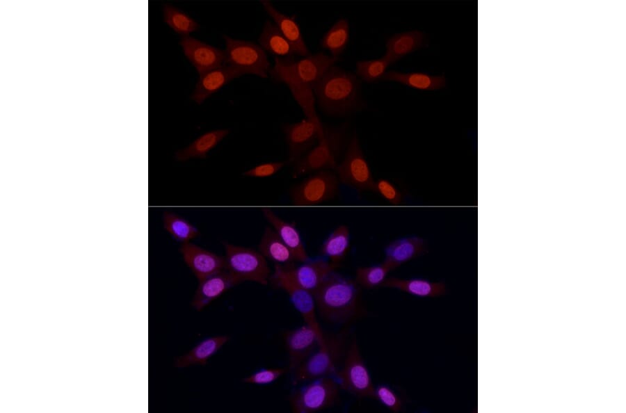 Immunofluorescence - Anti-Histone H3 (asymmetric di methyl Arg2) Antibody (A16730) - Antibodies.com