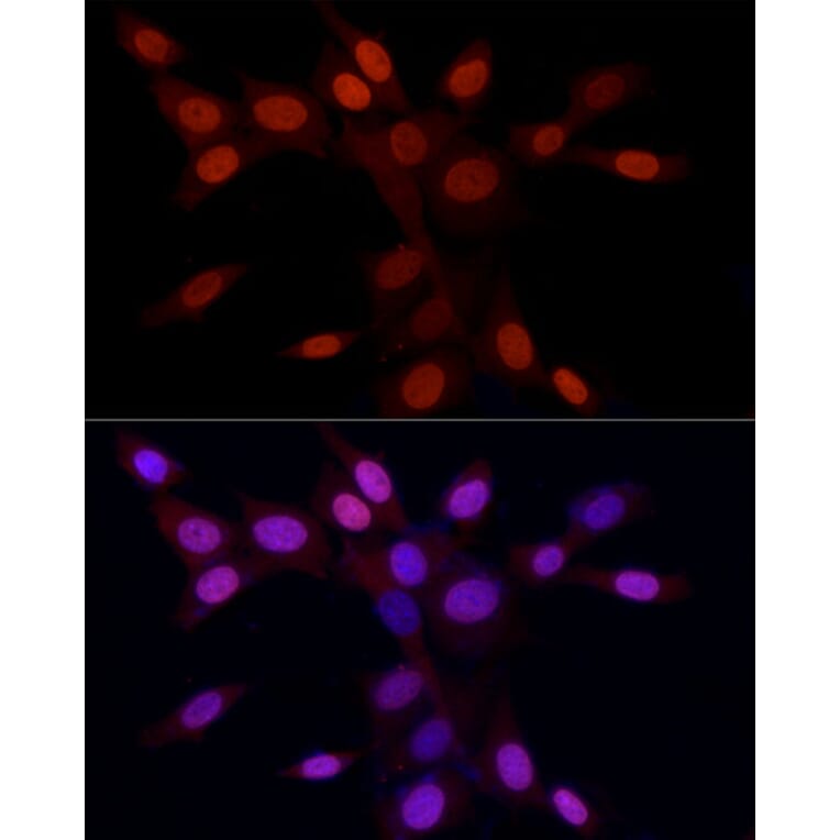 Immunofluorescence - Anti-Histone H3 (asymmetric di methyl Arg2) Antibody (A16730) - Antibodies.com