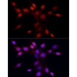 Immunofluorescence - Anti-Histone H3 (asymmetric di methyl Arg2) Antibody (A16730) - Antibodies.com