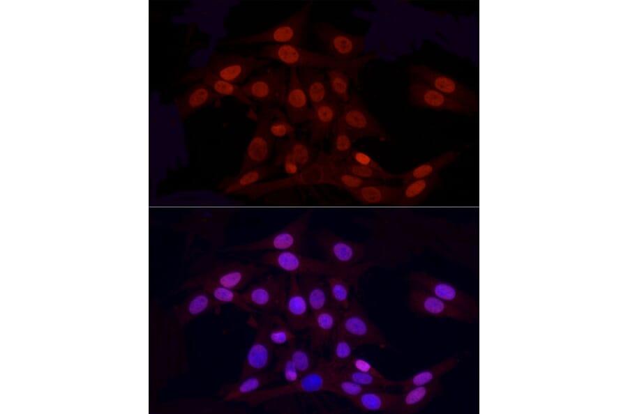Immunofluorescence - Anti-Histone H3 (asymmetric di methyl Arg2) Antibody (A16730) - Antibodies.com