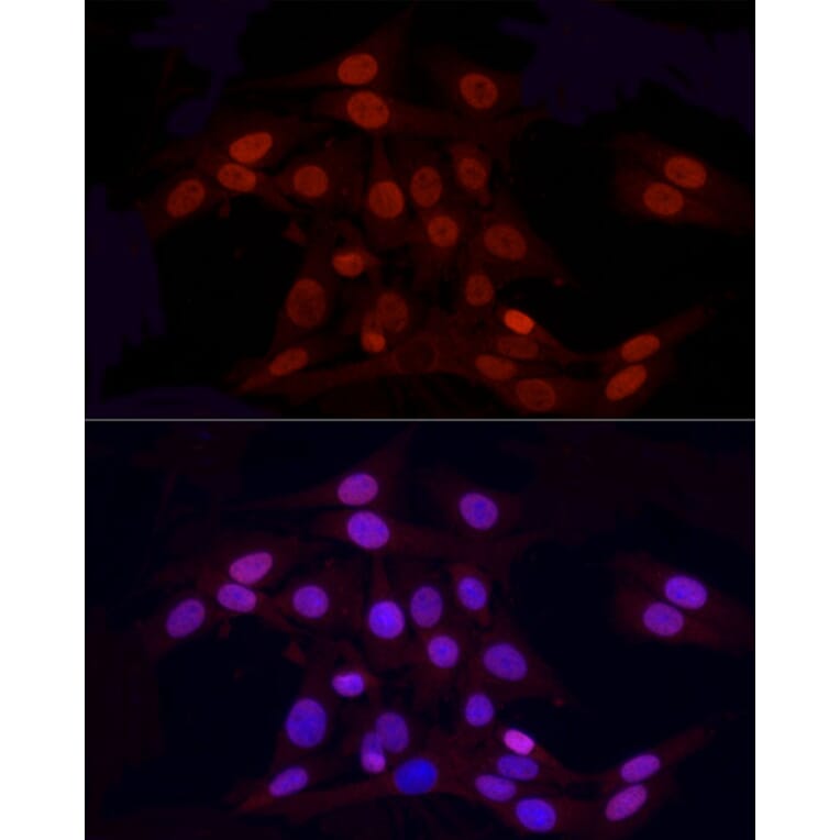 Immunofluorescence - Anti-Histone H3 (asymmetric di methyl Arg2) Antibody (A16730) - Antibodies.com