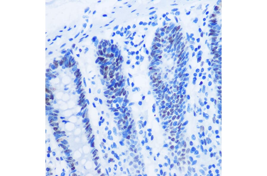 Immunohistochemistry - Anti-Histone H3 (asymmetric di methyl Arg8) Antibody (A16732) - Antibodies.com