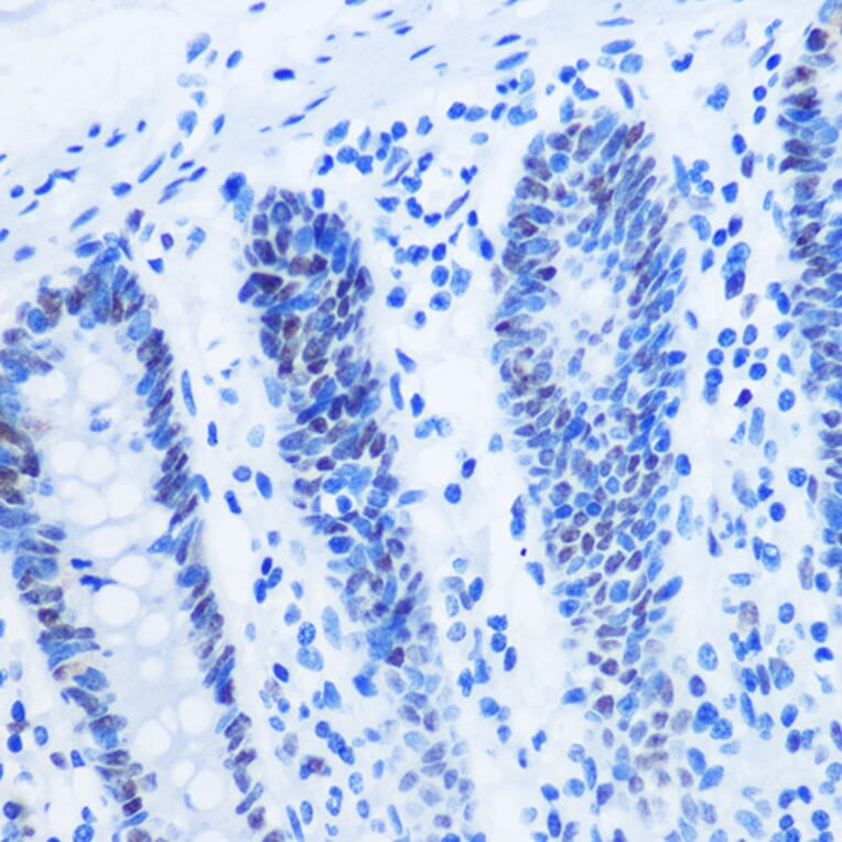 Immunohistochemistry - Anti-Histone H3 (asymmetric di methyl Arg8) Antibody (A16732) - Antibodies.com