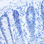 Immunohistochemistry - Anti-Histone H3 (asymmetric di methyl Arg8) Antibody (A16732) - Antibodies.com