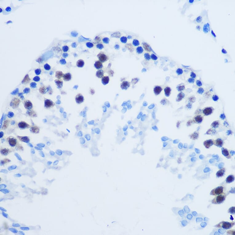Immunohistochemistry - Anti-Histone H3 (asymmetric di methyl Arg8) Antibody (A16732) - Antibodies.com