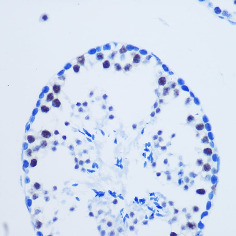 Immunohistochemistry - Anti-Histone H3 (asymmetric di methyl Arg8) Antibody (A16732) - Antibodies.com