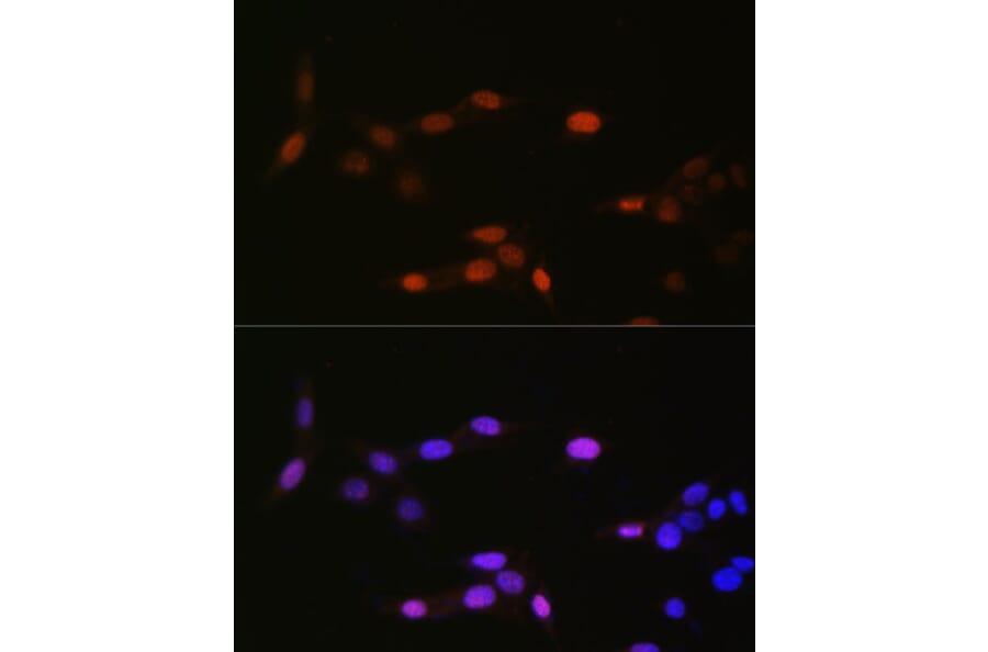 Immunofluorescence - Anti-Histone H3 (mono methyl Lys14) Antibody (A16735) - Antibodies.com