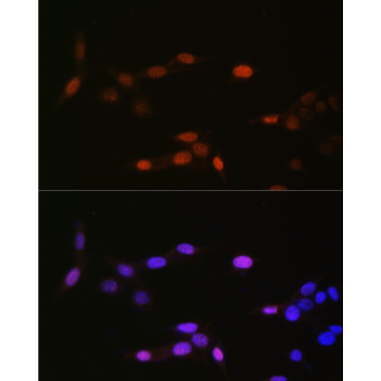 Immunofluorescence - Anti-Histone H3 (mono methyl Lys14) Antibody (A16735) - Antibodies.com