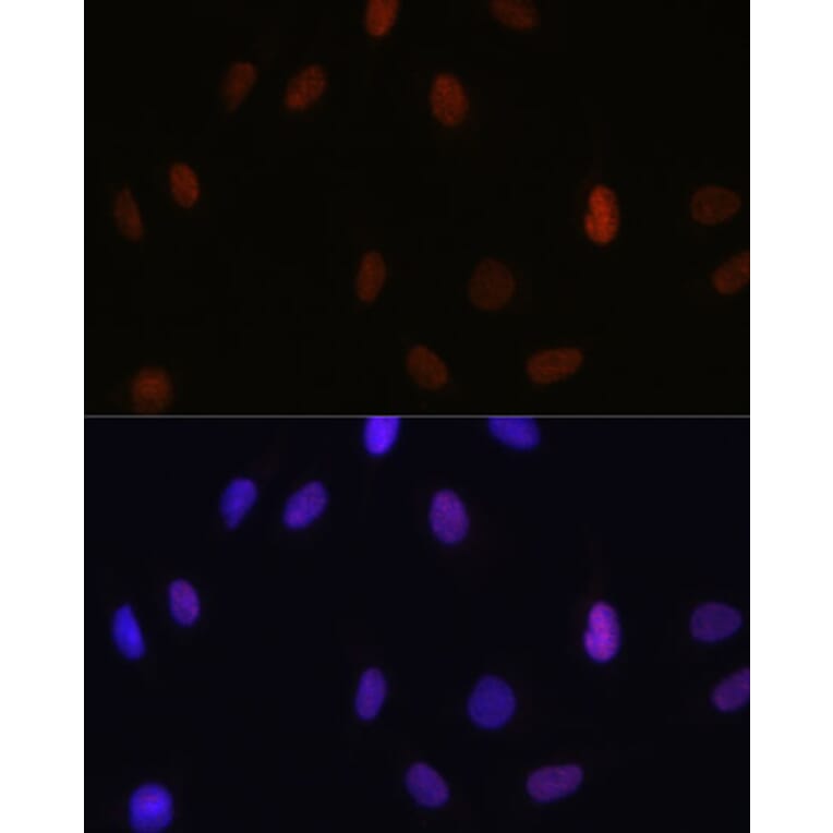 Immunofluorescence - Anti-Histone H3 (mono methyl Lys14) Antibody (A16735) - Antibodies.com