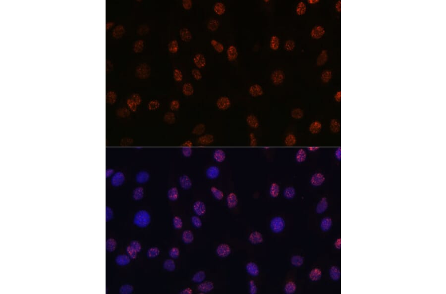 Immunofluorescence - Anti-Histone H3 (di methyl Lys14) Antibody (A16736) - Antibodies.com