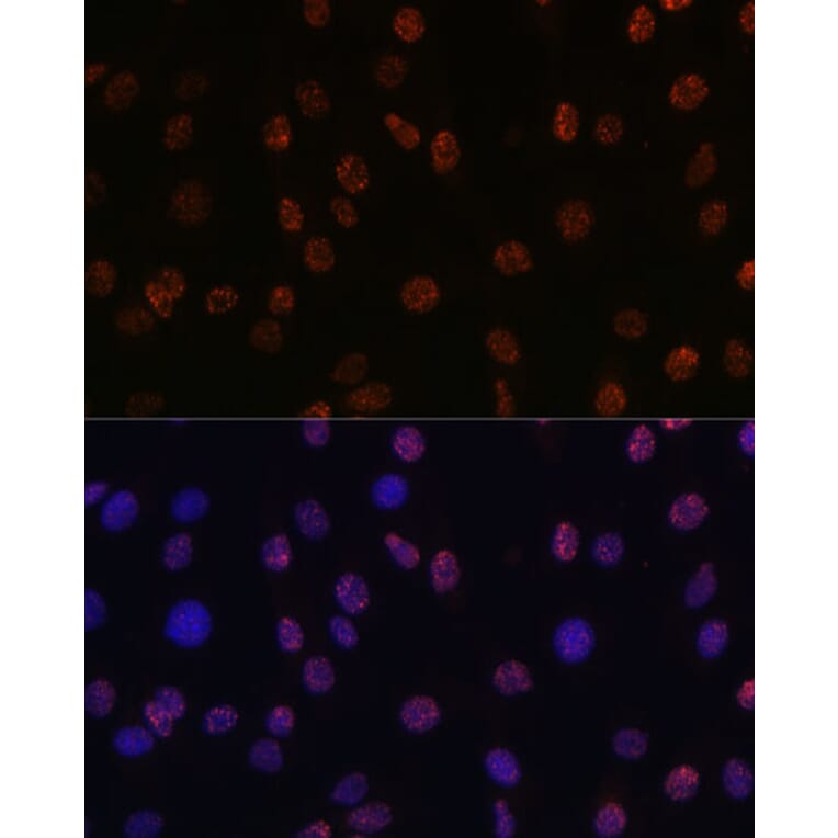 Immunofluorescence - Anti-Histone H3 (di methyl Lys14) Antibody (A16736) - Antibodies.com