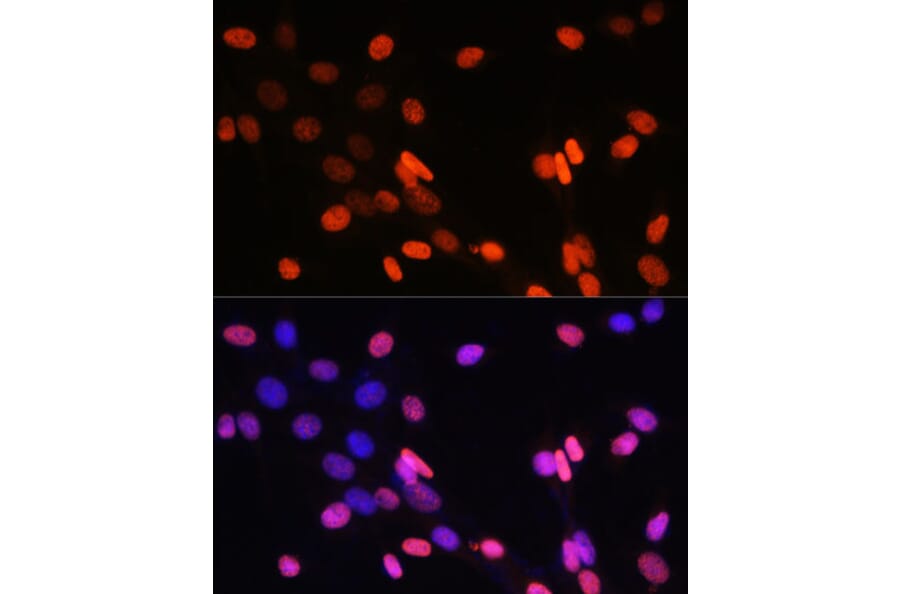 Immunofluorescence - Anti-Histone H3 (di methyl Lys14) Antibody (A16736) - Antibodies.com