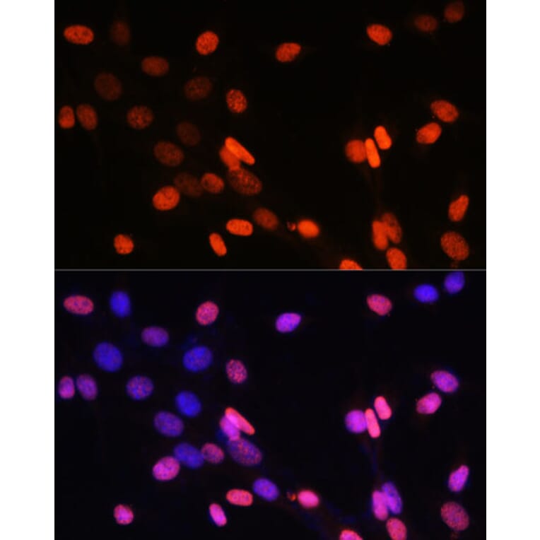 Immunofluorescence - Anti-Histone H3 (di methyl Lys14) Antibody (A16736) - Antibodies.com