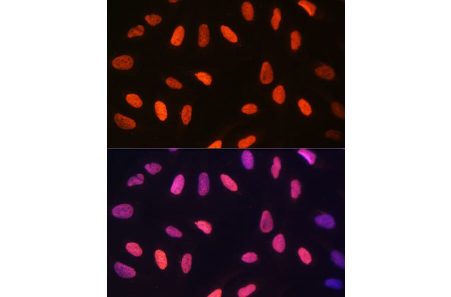 Immunofluorescence - Anti-Histone H3 (di methyl Lys14) Antibody (A16736) - Antibodies.com