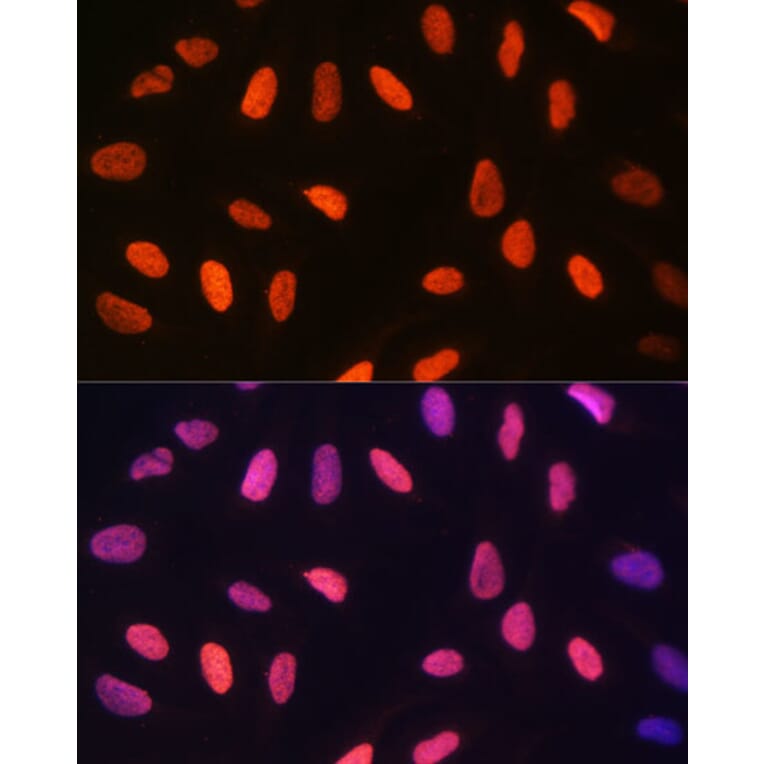 Immunofluorescence - Anti-Histone H3 (di methyl Lys14) Antibody (A16736) - Antibodies.com