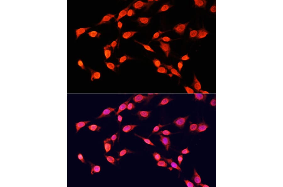 Immunofluorescence - Anti-Histone H3 (tri methyl Lys14) Antibody (A16737) - Antibodies.com