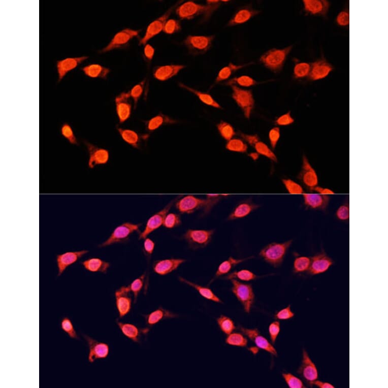 Immunofluorescence - Anti-Histone H3 (tri methyl Lys14) Antibody (A16737) - Antibodies.com